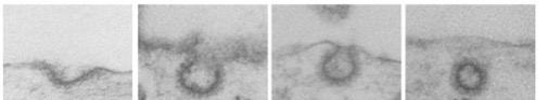 Elektronenmikroskopische Aufnahmen einer Endocytosen