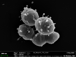Eine Raster-EM-Aufnahme (REM): Phagen adsorbiert an Enterococcus faecium-Zellen.